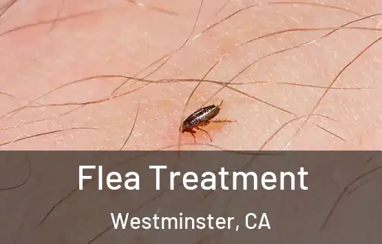  Flea Treatment Westminster, CA